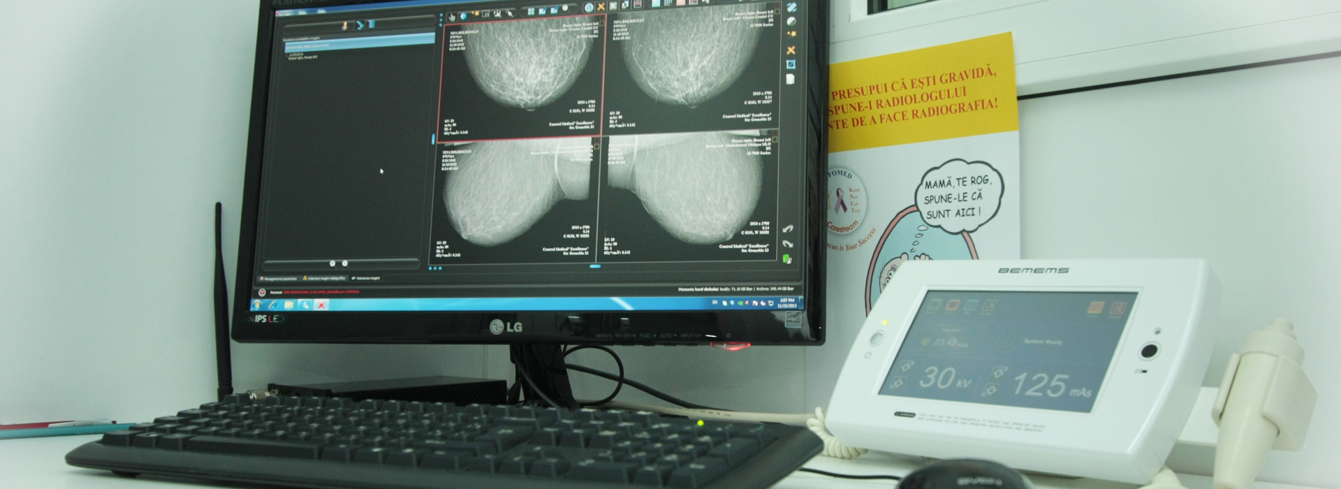 statia radiotehnician mamograf mobil